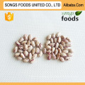 Business Opportunities Distributor Light Speckled Kidney Beans